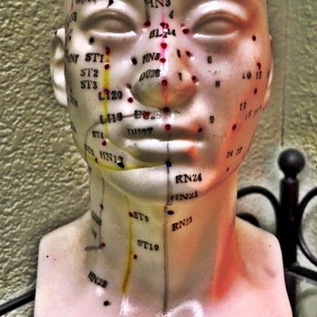 Shirley McWilliams Acupuncture - Acupuncture Near Me - Fresno, California