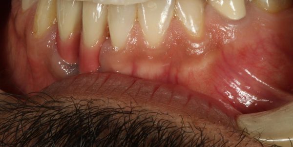 Rubenstein Dental Group