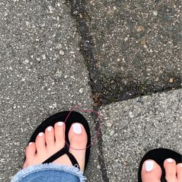 Crooked big toe Crooked big toe
