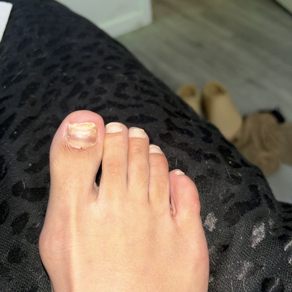 Beellagio Nail Bar - fungal infection - Nail Salons Near Me - Atlanta, Georgia Beellagio Nail Bar - fungal infection - Nail Salons Near Me - Atlanta, Georgia