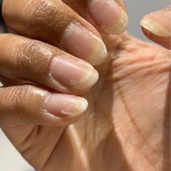 Bellaviva Nail Bar - After removal process
