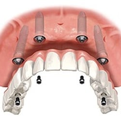 Bright Dental of Logan Square