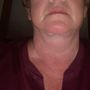 Lyle M Back, MD