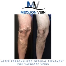 Mequon Vein - Germantown