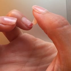 Atlanta Nails - This was when they ripped my nail off instead of soaking.