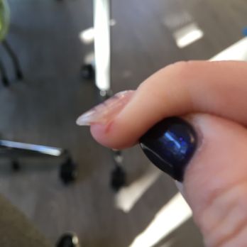 Creative Nails & Lounge - Photo of my right ring finger that the nail technician filed and cut open my skin. - Nail Salons Near Me - Hingham, Massachusetts
