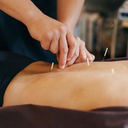 AcuTherapy & Herbal Medicine