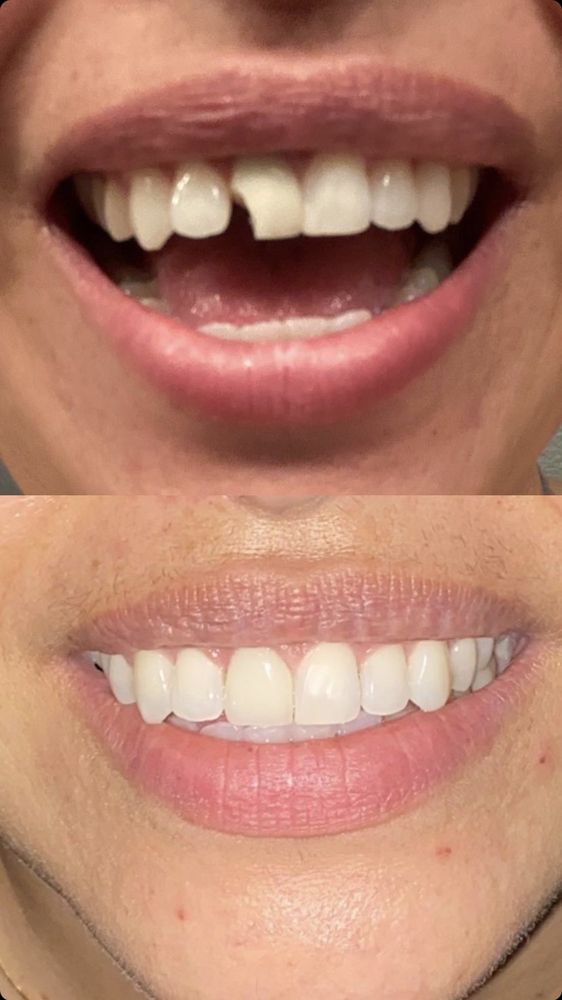 SANTEE COTTONWOOD DENTAL Updated October 2024 36 Reviews 236