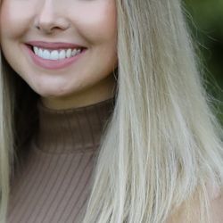 Nadine Ferbinteanu, DDS -Maple Dentistry - After