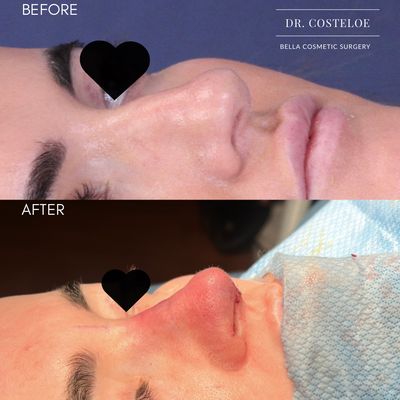 lip flip washington d.c. TOP 10 BEST Botox Lip Flip in Washington, DC - Updated 2026 - Quality &  Affordability
