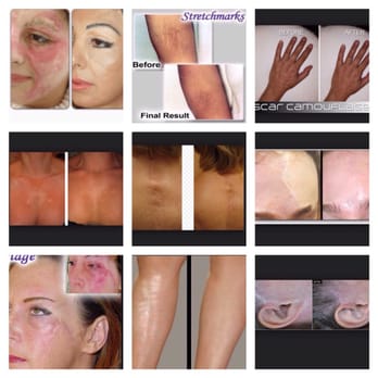 Forever Ink - Permanent Makeup Near Me - Akron, Ohio