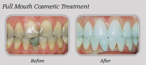 Gentle Care Family Dentistry Logo