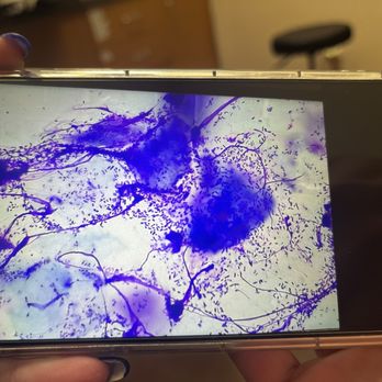 East Valley Urgent Pet Care - Pseudomonas otitis are the rod looking bacteria - Veterinarians Near Me - Mesa, Arizona East Valley Urgent Pet Care - Pseudomonas otitis are the rod looking bacteria - Veterinarians Near Me - Mesa, Arizona