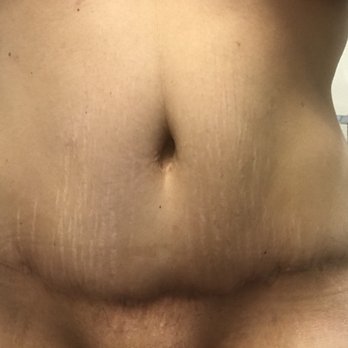 Tehrani Plastic Surgery - Cosmetic Surgeons Near Me - Newport Beach, California Tehrani Plastic Surgery - Cosmetic Surgeons Near Me - Newport Beach, California