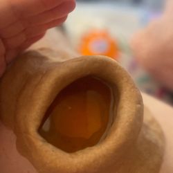 Mother Earth Ayurveda and Intuitive Guidance - A traditional Ayurvedic knee basti, warm medicated oil held in place to soothe inflammation, ease pain, and deeply nourish the joints.