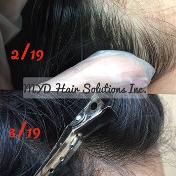 MYD Hair Solutions - Hair Loss Centers Near Me - Smithtown, New York MYD Hair Solutions - Hair Loss Centers Near Me - Smithtown, New York