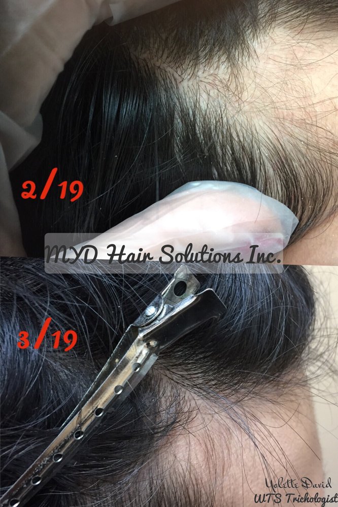 MYD Hair Solutions Logo