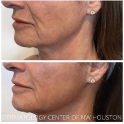 Dermatology Center of Northwest Houston: Lisa Hitchins, MD