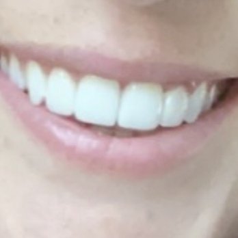 Kuljic DDS & Team - Cosmetic Dentists Near Me - Beverly, Massachusetts