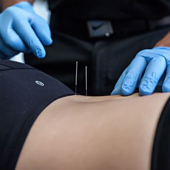 Impact Physical Therapy - Physical Therapy Near Me - Phoenix, Arizona Impact Physical Therapy - Physical Therapy Near Me - Phoenix, Arizona