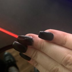 DIP Nails - Chipped, peeled and uneven. The black polish on my cuticle makes it look like dirt on my hand