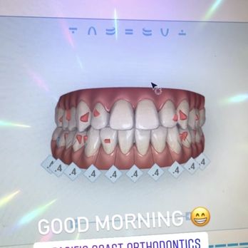 Pacific Coast Orthodontics - High tech ortho dentistry! - Orthodontists Near Me - San Ramon, California Pacific Coast Orthodontics - High tech ortho dentistry! - Orthodontists Near Me - San Ramon, California