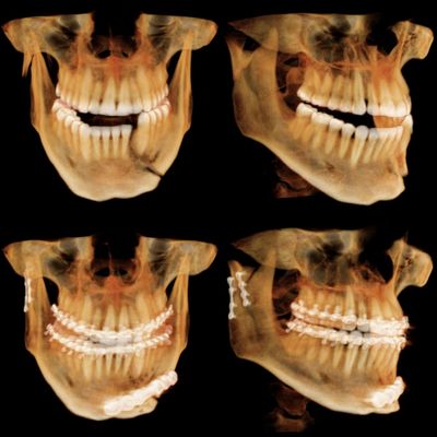 Piney Point Oral & Maxillofacial Surgery of Katy & Cypress