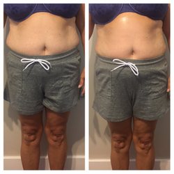 Tan N' Toned - Results after one 1hour sculpting treatment
