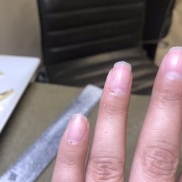 Blood on my ring finger and pinky