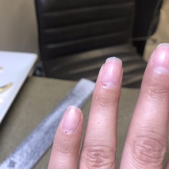 Lavish Nail Lounge - Blood on my ring finger and pinky - Nail Technicians Near Me - Sarasota, Florida