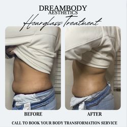 Dream Body By Lex - Amazing client results. Definitely snatched her waist and added some back fat treatment