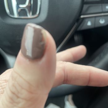 En Vogue Nails & Spa - This is the day after my fill. - Skin Care Near Me - Branson, Missouri En Vogue Nails & Spa - This is the day after my fill. - Skin Care Near Me - Branson, Missouri
