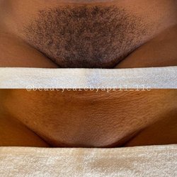 Simply Skin Medical Aethetics