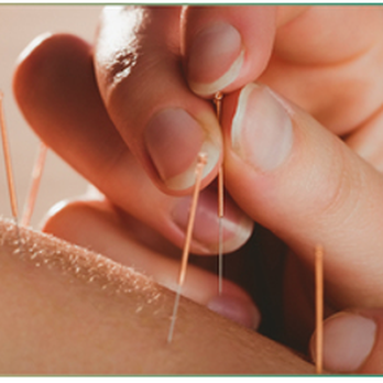 Abundant Life Well-Being - The ancient wisdom of Acupuncture and Oriental Medicine - Hypnosis/Hypnotherapy Near Me - Lakeside, Arizona Abundant Life Well-Being - The ancient wisdom of Acupuncture and Oriental Medicine - Hypnosis/Hypnotherapy Near Me - Lakeside, Arizona