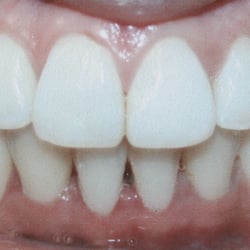 Broadbent Orthodontics