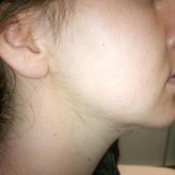 Jabulani Kosmetic Laser Spa