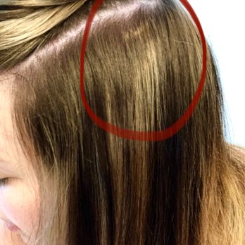 Salon RISE - Hair by Aimee. Bleach bleed mark, one of many. - Hair Stylists Near Me - Tacoma, Washington