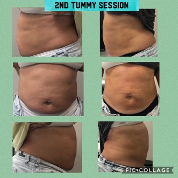 Inspire Beauty - Body Contouring Near Me - Austin , Texas Inspire Beauty - Body Contouring Near Me - Austin , Texas