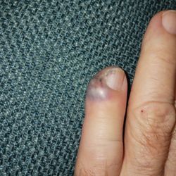 Patient First Primary & Urgent Care - Hampton - Before recommended treatment.