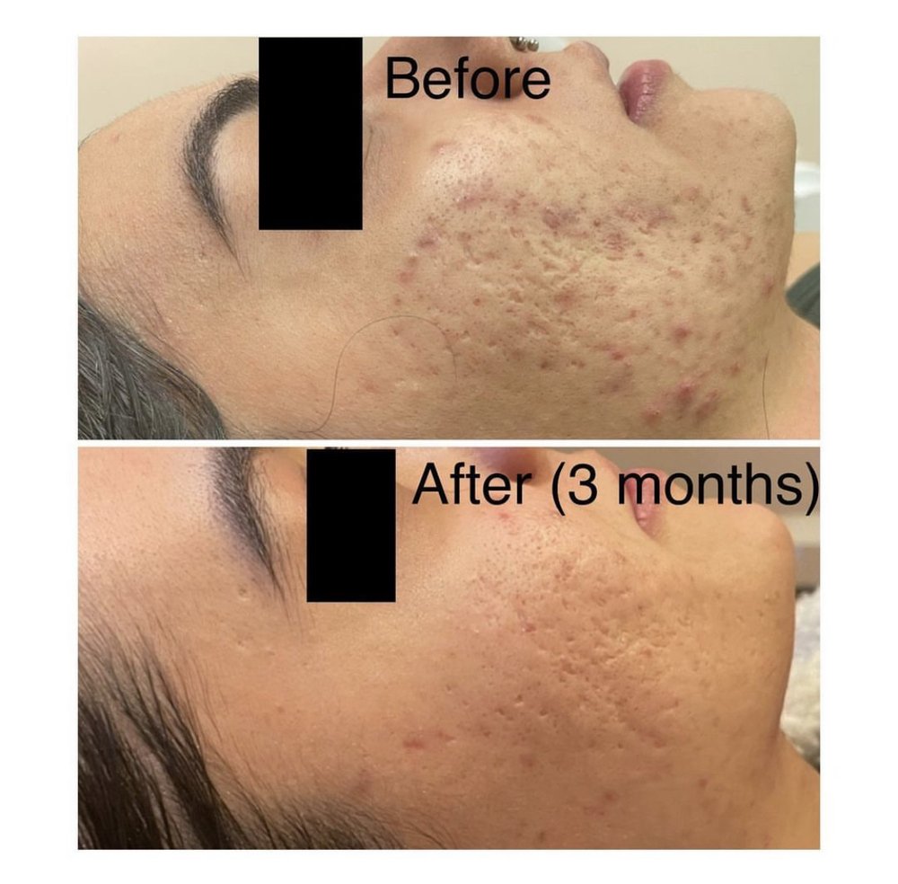 Skin Positive Logo