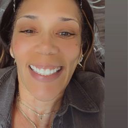 San Tan Valley Smiles - Braces removed