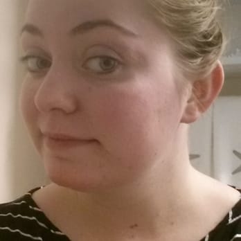 Simply Smooth - Redness gone 15 minutes later! By now (with normal wax) I would be breaking out and itchy! Thanks Jen for introducing me to sugar! - Sugaring Near Me - San Ramon, California