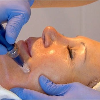 Luxury on Lovers - The SkinPen creates microscopic channels to boost collagen and fight fine lines and wrinkles without downtime. (WFAA 8) - Day Spas Near Me - Dallas, Texas Luxury on Lovers - The SkinPen creates microscopic channels to boost collagen and fight fine lines and wrinkles without downtime. (WFAA 8) - Day Spas Near Me - Dallas, Texas