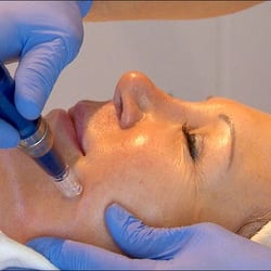 Luxury on Lovers - The SkinPen creates microscopic channels to boost collagen and fight fine lines and wrinkles without downtime. (WFAA 8)