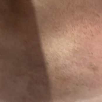 SUGARED + BRONZED - Hair Removal Near Me - Miami, Florida