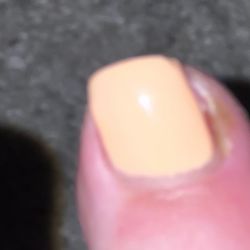 Nancy's Salon - Toe irritated/infected