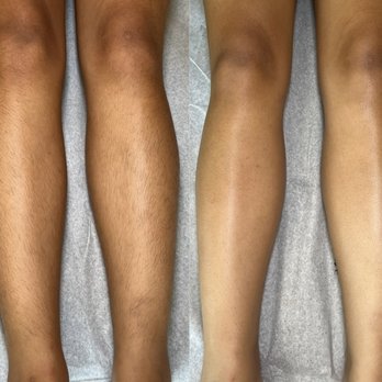 Skinxrae - Full Leg Wax - Waxing Near Me Skinxrae - Full Leg Wax - Waxing Near Me