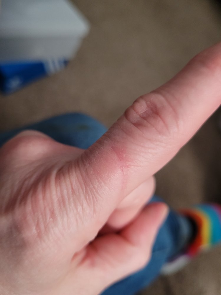 RIDGEVIEW CLINICS & URGENT CARE IN BELLE PLAINE Updated September