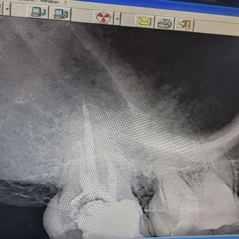 Paul N T Nguyen, DDS - Endodontists Near Me - Irvine, California Paul N T Nguyen, DDS - Endodontists Near Me - Irvine, California