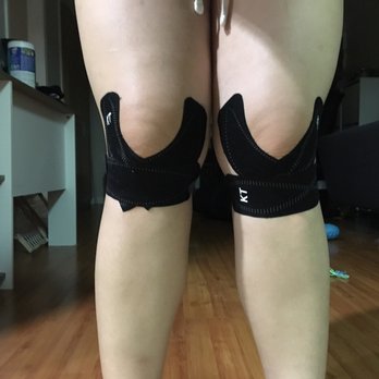 AcuNurture Acupuncture & Herbs - Kt tape both knees for support - Acupuncture Near Me - Duarte, California AcuNurture Acupuncture & Herbs - Kt tape both knees for support - Acupuncture Near Me - Duarte, California